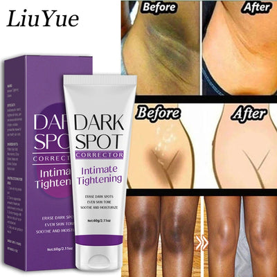 Quickly Underarm Remove Darkness Cream